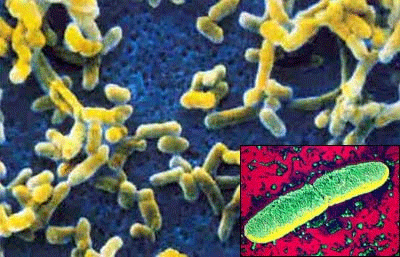 ������ ������� (Yersinia pestis)