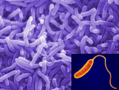 �������� ������� (Vibrio cholerae)