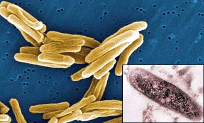 ������������ ����������� (Mycobacterium tuberculosis, ������� ����)